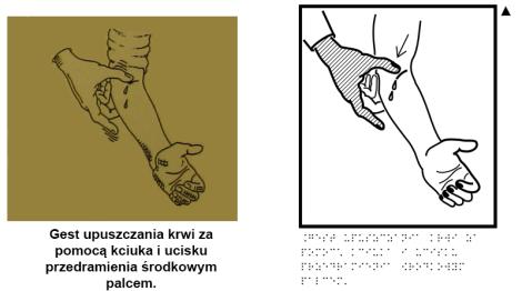 Photo no. 4 (5)
                                                         Gest upuszczania krwi za pomocą kciuka i ucisku przedramienia środkowym palcem.
                            